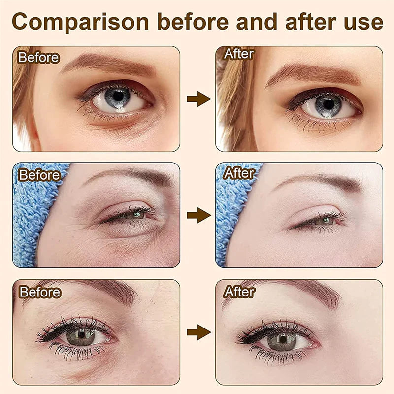 ✨New Year Sale-Up to 50% Off✨Temporary Firming Eye Cream