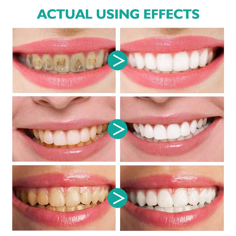 Whitening Foam Toothpaste