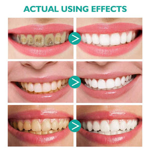 Whitening Foam Toothpaste