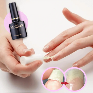 NAIL REPAIR PROTECTION GEL